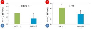 フラーレン「たるみ改善」を臨床試験で確認 8 main