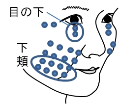 フラーレン「たるみ改善」を臨床試験で確認 7 sub1