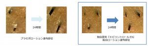 ミュゼ「抑毛効果のある独自原料」を開発 9 9b5c0c1f7374ba03c59a900f60088e28 1