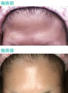 商品力と結果は もちろん、企業姿勢 にも共感して導入 8 salontool cosmemachine2018 pilica03