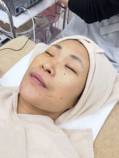 イオンザイムDF-Ⅲとエンビロンが証明するビタミンAの美肌効果 23 salontool 20181225 environ 04