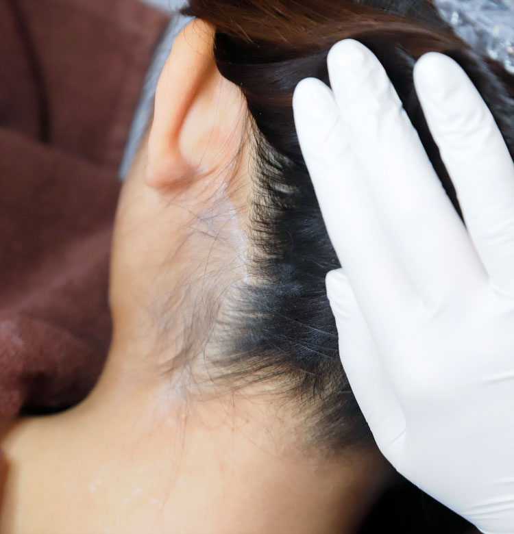 salontool epilation2019 angelica step1 before