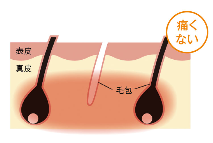 salontool epilation2019 estlab shr