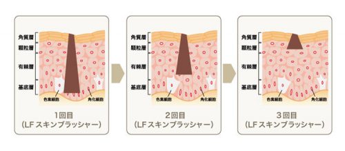 salontool machinebest11 2019 forest theory1