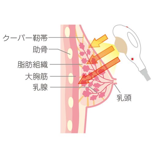 <脱毛機>ヴィクトリアなら脱毛集客はもちろん コース追加まで狙える! 25 salontool machinebest11 2019 globalsc theory3