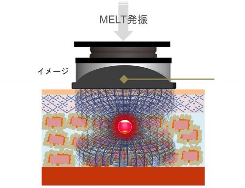 <痩身機器>パラボラ痩身法はオリジナルメソッド。パイラソード 20 salontool machinebest11 2019 links theory1