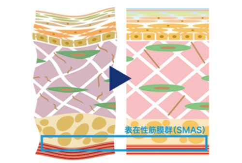<フェイシャル複合機>マキシマムフォーだけで開業も可能な多機能 21 salontool machinebest11 2019 toyookaB theory01