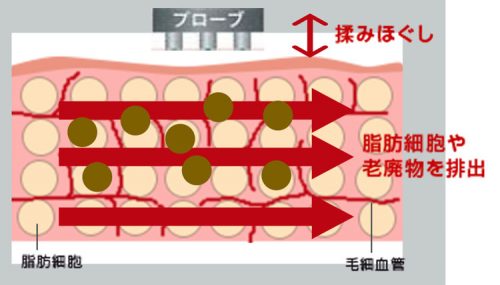 <RF痩身機器>癒しと結果の両方をかなえるハイパーナイフ 21 salontool machinebest11 2019 wamu theory2
