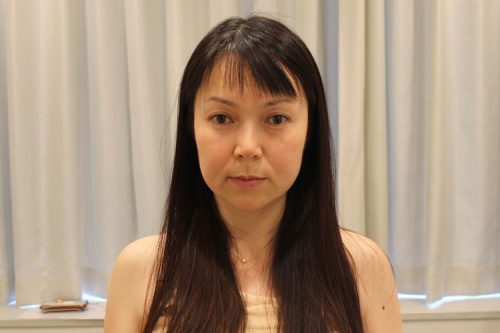 NMNを配合!N2アクセルスーペリアエッセンス フェイシャルの実力 44 column saerepo 20190626 axxzia 0124