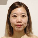 塗る針ケア『ミラクルトックス』の業務用が新登場! 驚きの実力とは? 39 salonwork 7935