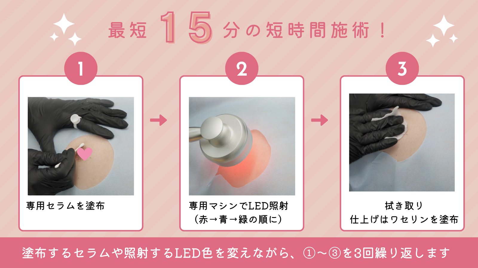 エステティック通信読者に速報! 黒ずみケアの次世代施術「ローマピンク(Roma Pink)」の全貌に迫る 14 image12